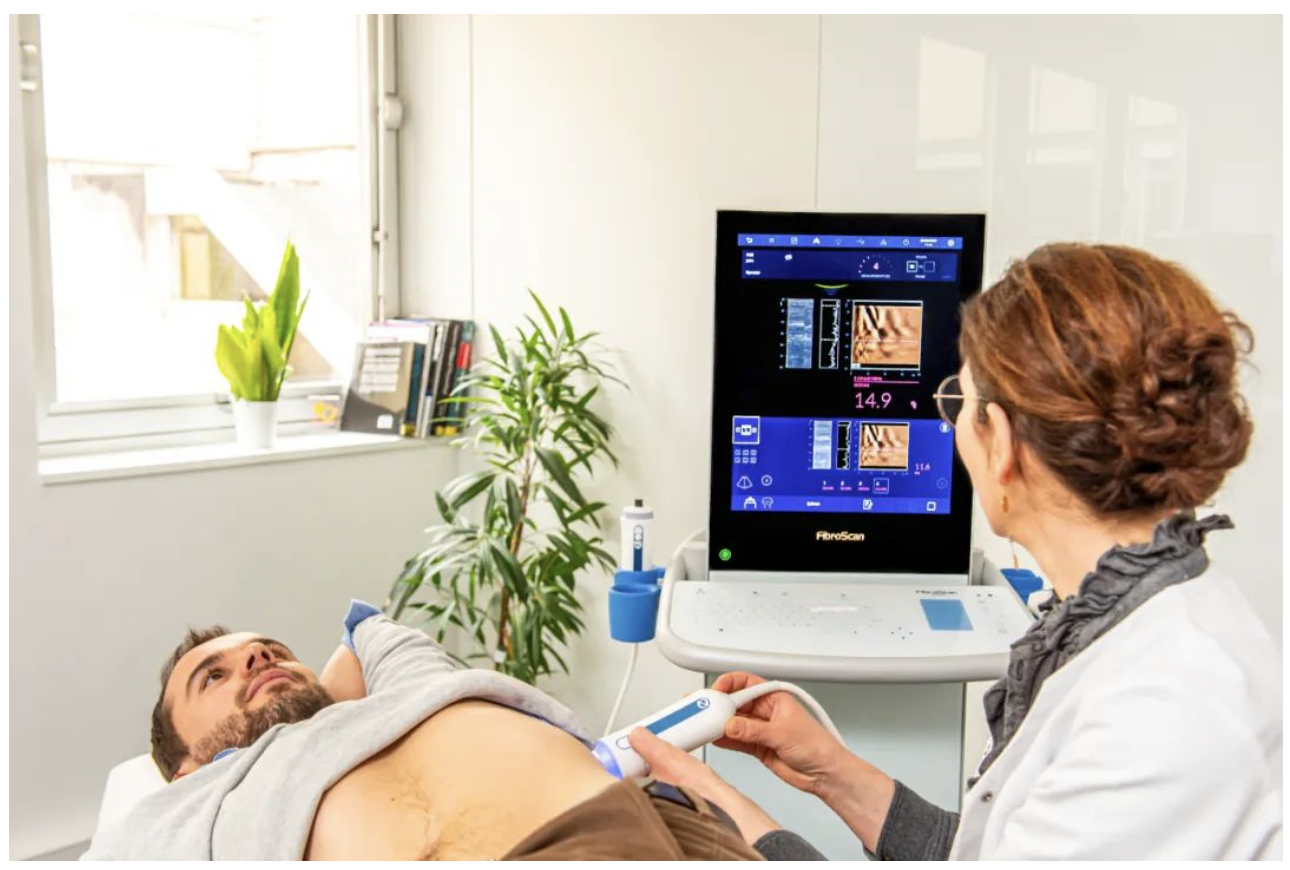 爱科森?学院专栏 | FibroScan?全球指南与共识推荐介绍（门静脉高压篇）