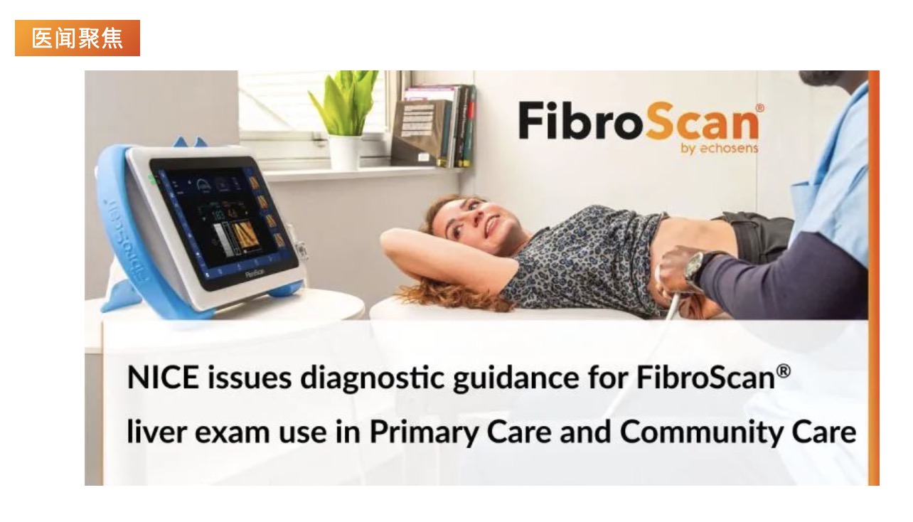 医闻聚焦 | NICE发布具有里程碑意义的指导意见，将常规肝脏扫描引入初级保健机构
