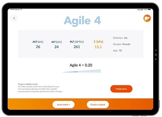 Agile 4