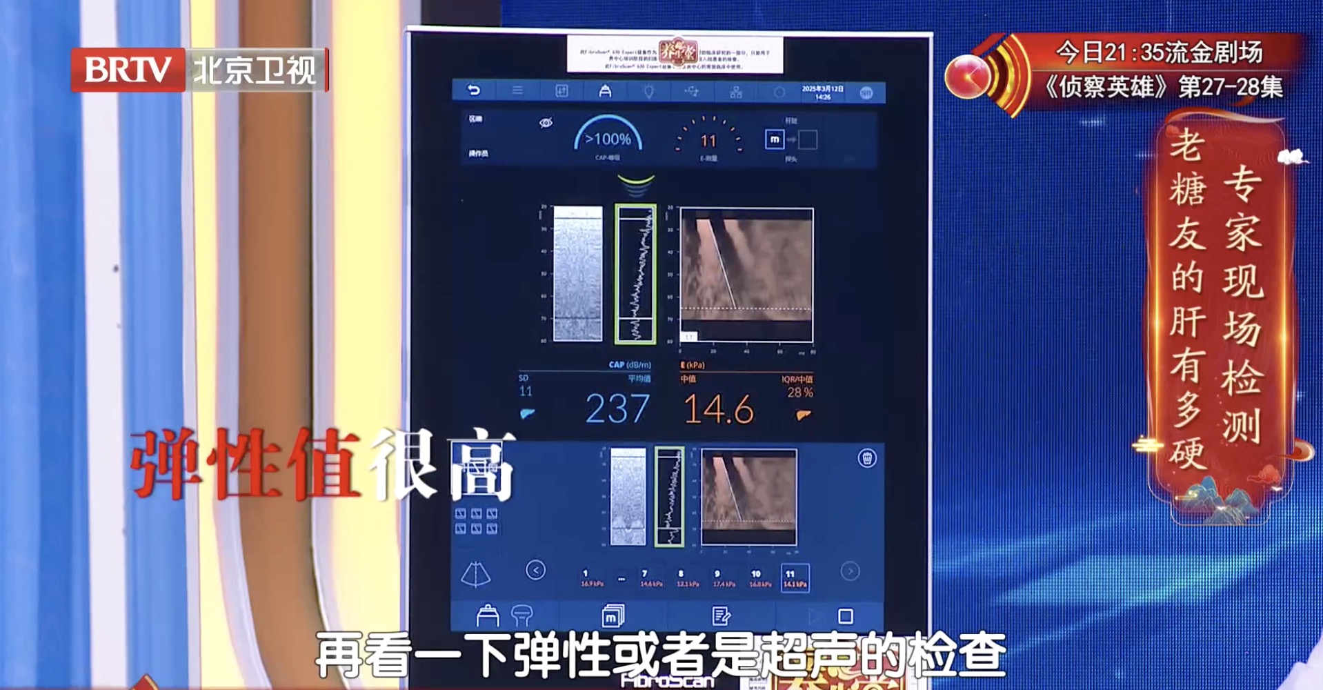 糖尿病肝损伤到底有多严重